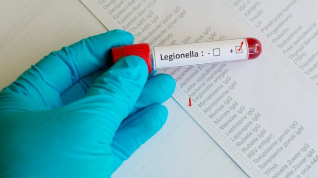 Control de Legionellosis con Alerta de Covid19
